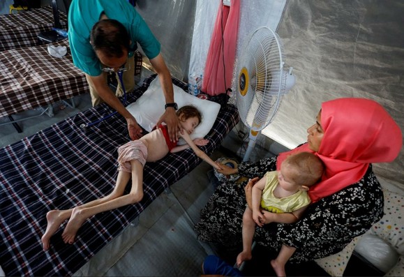 Photo of skin and bones Palestinian child starving